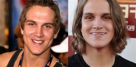 jason mewes teeth scam.